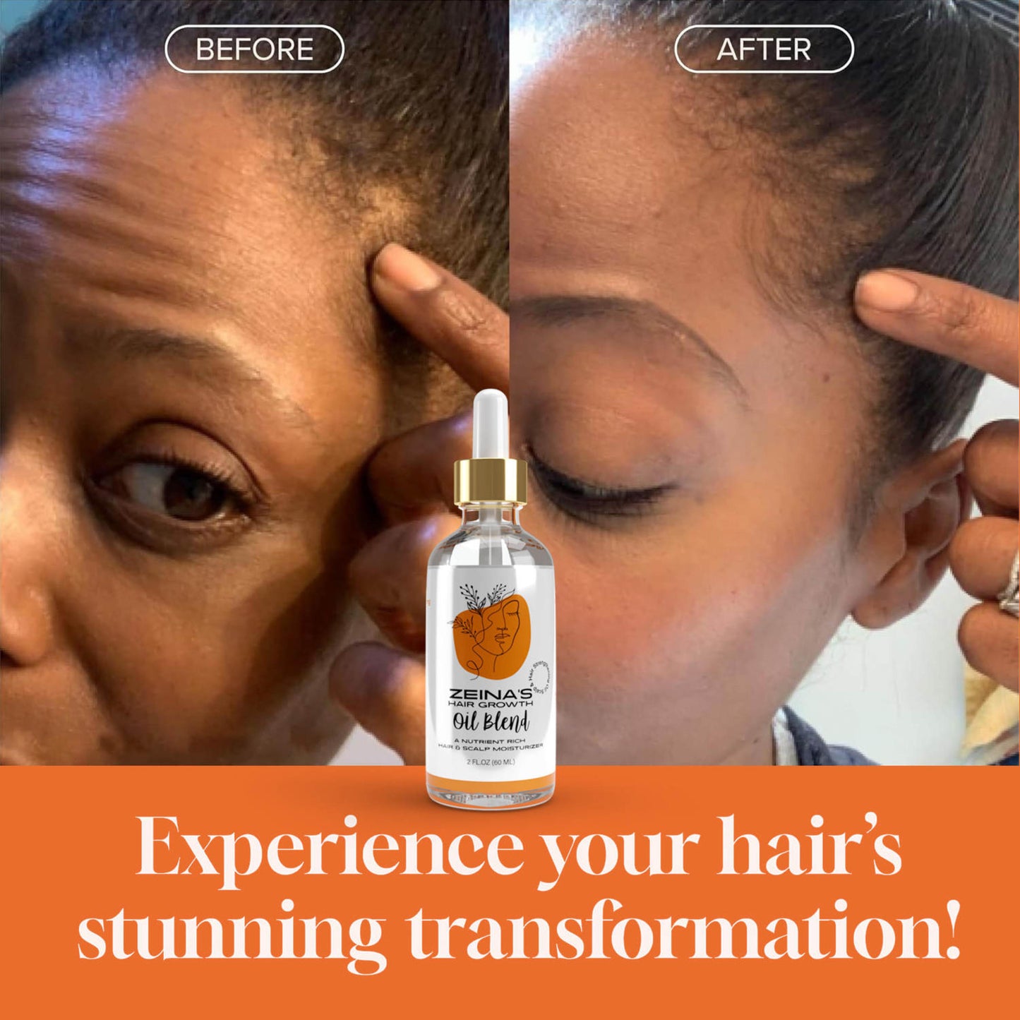 Hair Growth Oil Blend